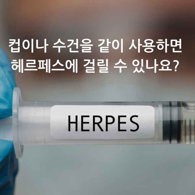 헤르페스 2형 FAQ